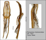 Female