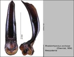 Female